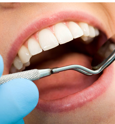 اكتشف سر إصابة أسنانك بالتسوس رغم تنظيفها باستمرار