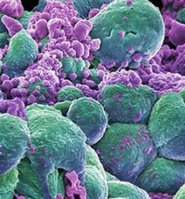 "الملقاط النانو" أحدث علاج للخلايا السرطانية