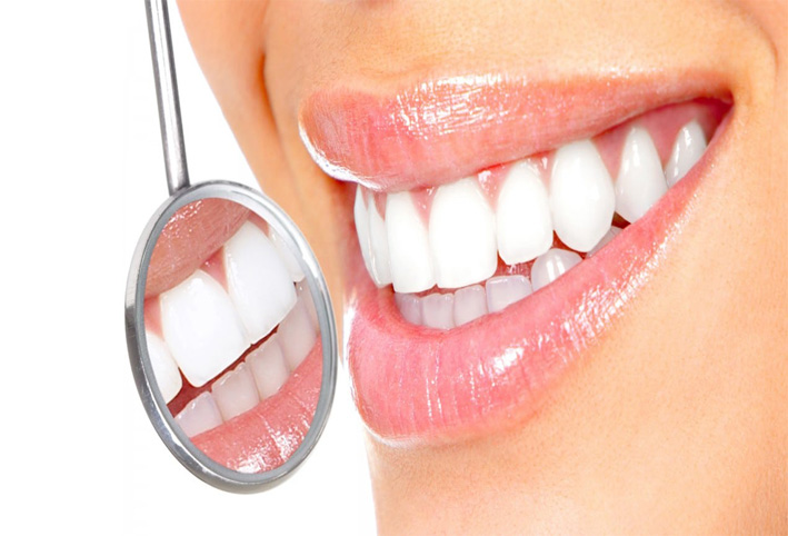 أسرع 3 طرق لعلاج تسوس الأسنان