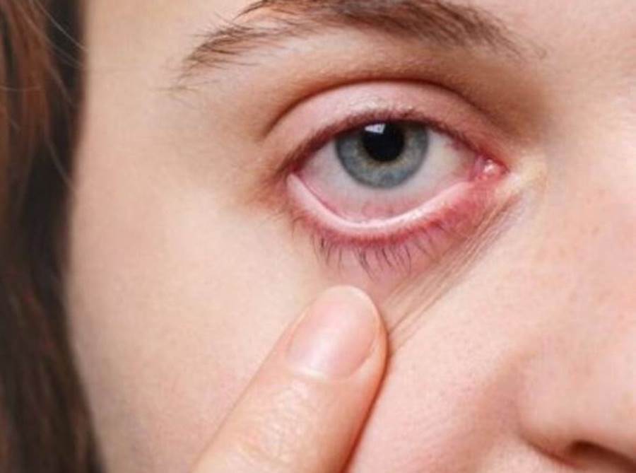 هل يمكن أن تظهر أعراض سرطان الجلد فى العين؟ 