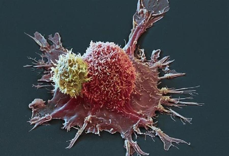 تخليق جزيء اصطناعي قاتل لخلايا السرطان