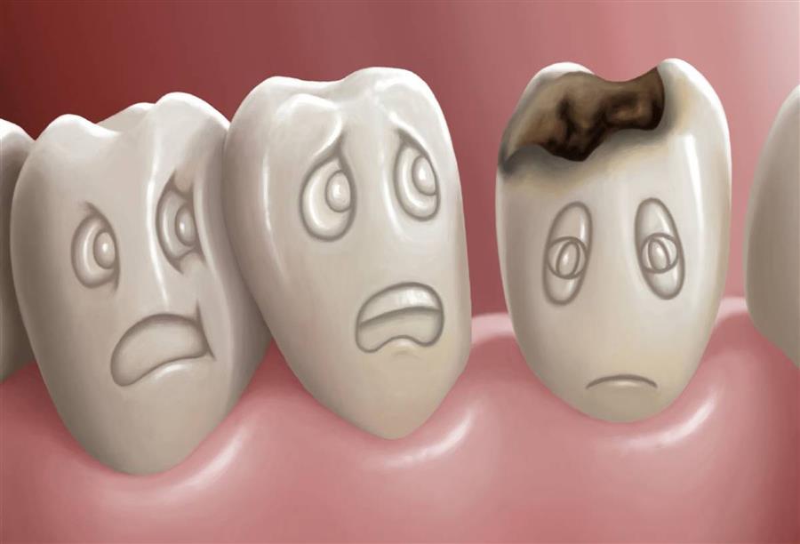 أشعة الليزر .. تكافح تسوس الأسنان وتساعد المينا في اكتساب الفلور