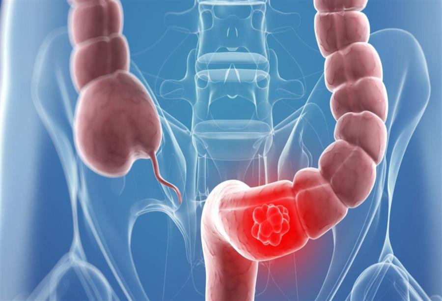 مما لا شك فيه أن النتائج ما تزال متواضعة إنما واعدة