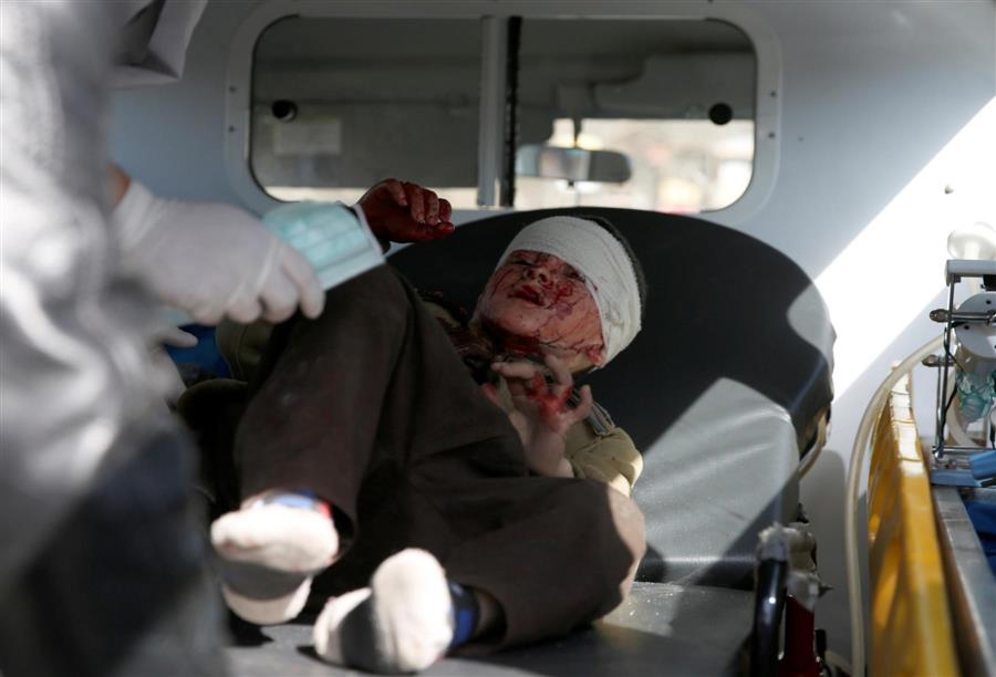 الأطفال .. ضحايا صور الجثث والأجساد المشوهة في غزة