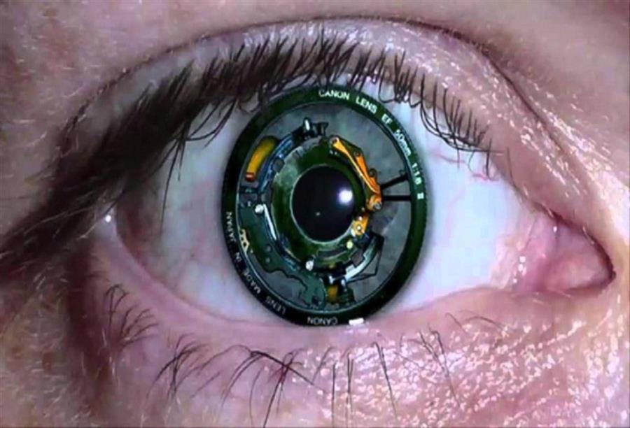 عين اصطناعية تهب البصر بعد 30 سنة من فقدانه