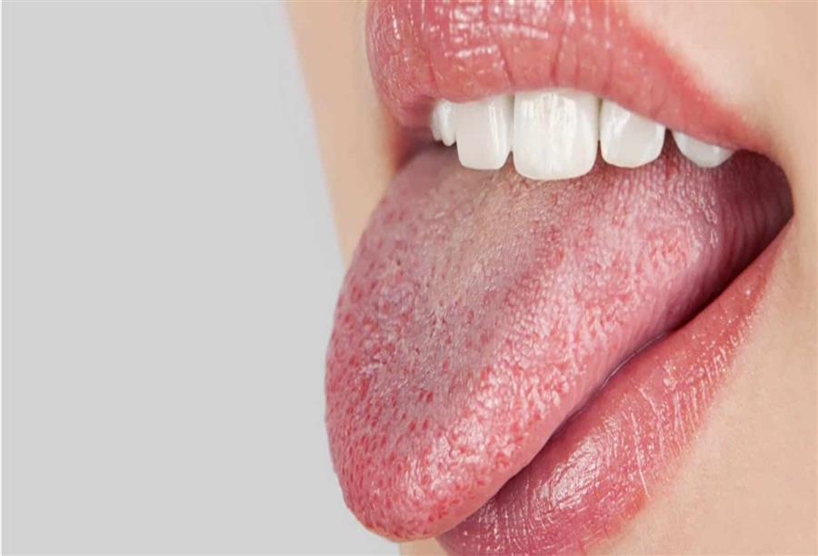 قد ينجم جفاف الفم عن التنفس عبر الفم وتناول بعض الأدوية