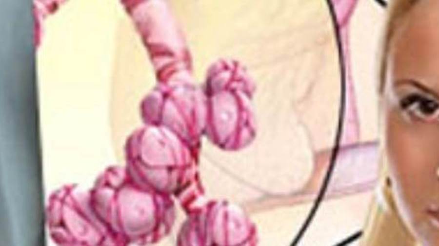 إن المرض يحدث عندما يبدي جهاز المناعة رد فعل مبالغ فيه تجاه دخول مادة سامة Toxin أو دواء أو جراثيم بكتيريا أو فيروسات جسم الإنسان