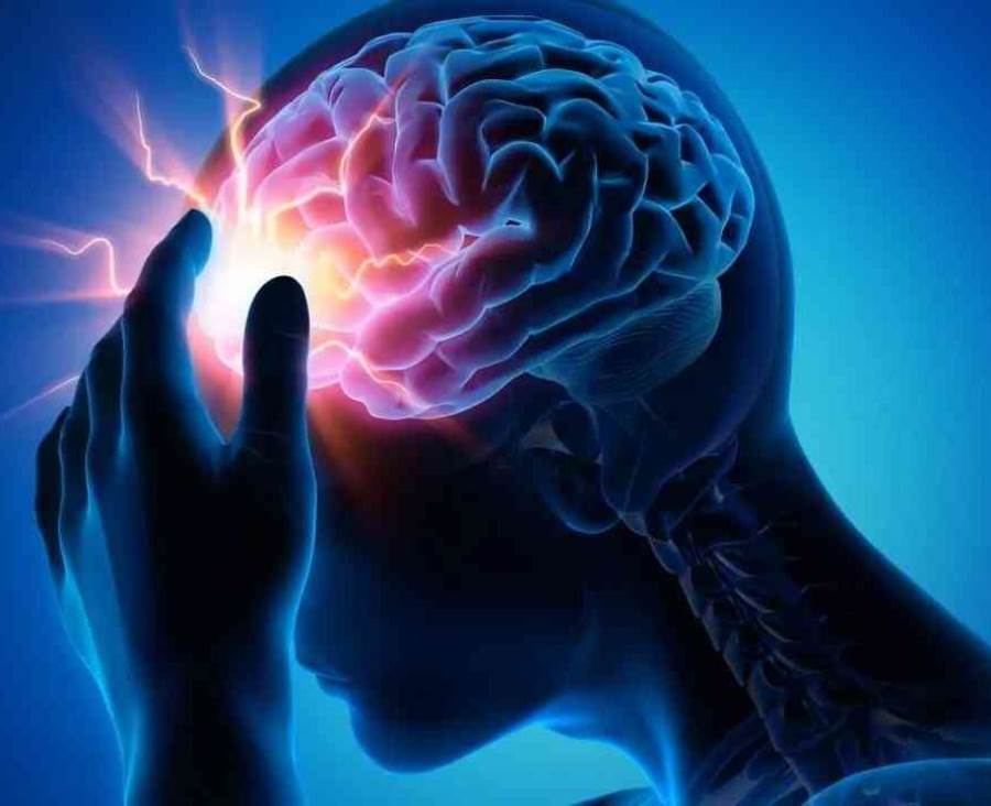 هل تستطيع السكتات الدماغية الصامتة محو الذاكرة؟ 