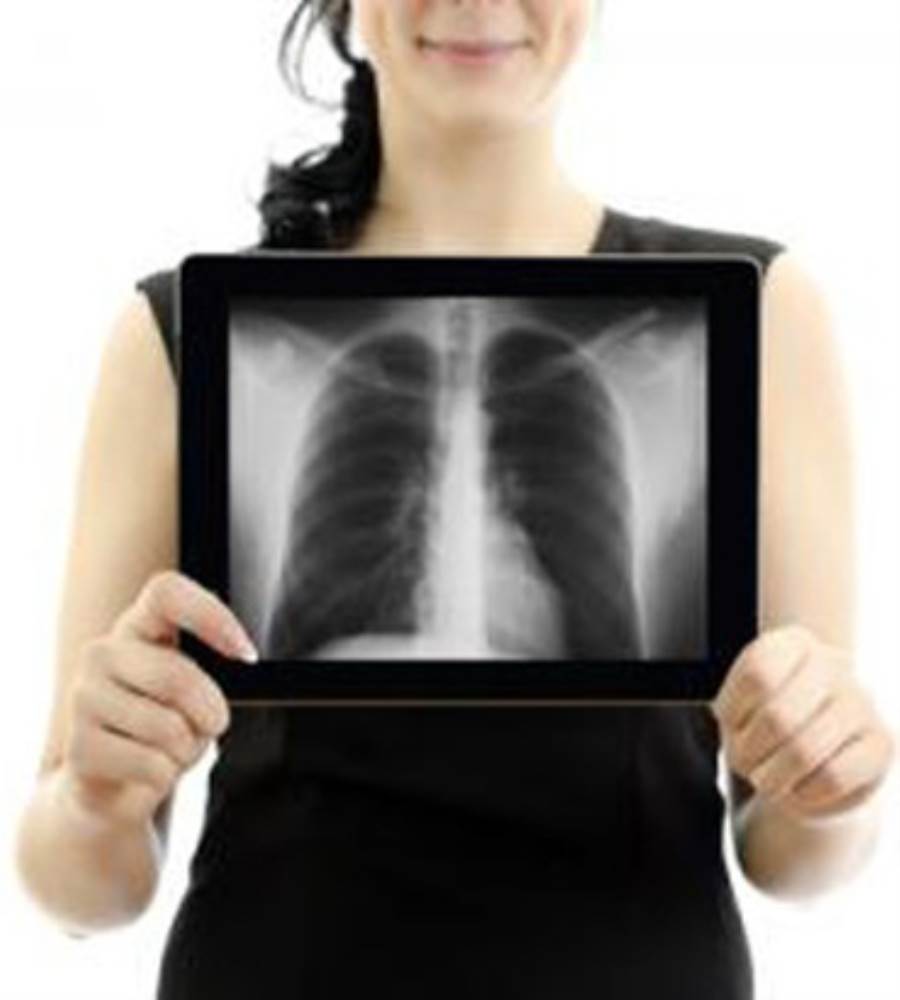 العلاقة الغريبة بين المرأة وسرطان الرئة .. اقرأي التفاصيل