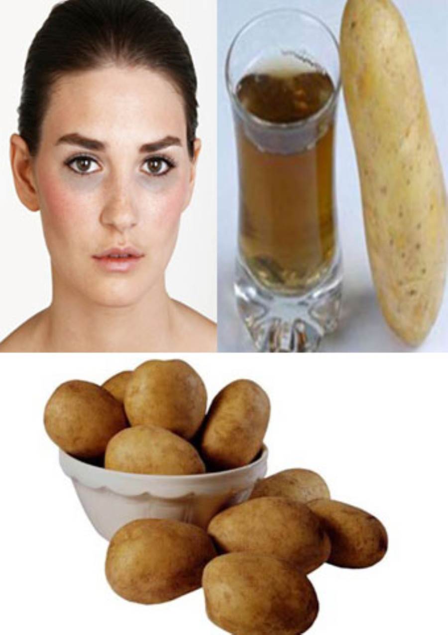عصير البطاطس .. لعلاج الهالات السوداء وتفتيح البشرة