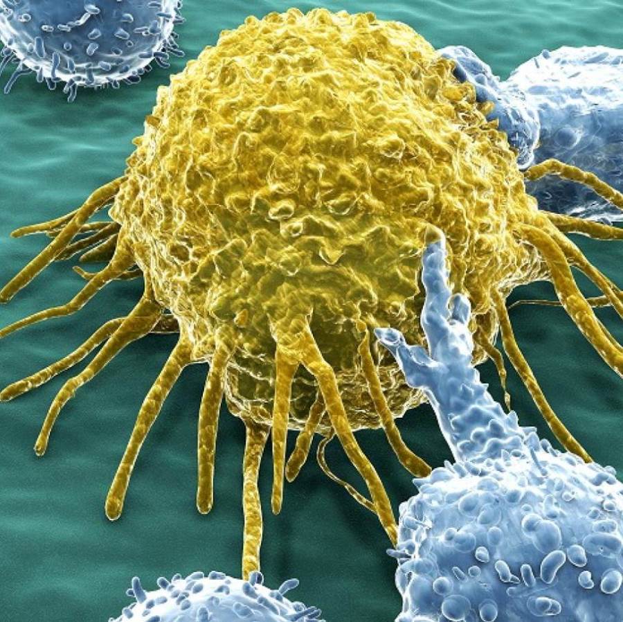 جرعة وريدية من الفيتامينات تقتل الخلايا السرطانية