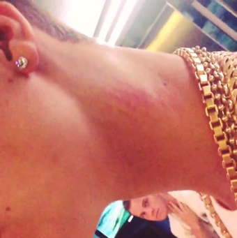 ماذا حدث لجاستين بيبر بعدما سقط من أعلي الدرج؟ 