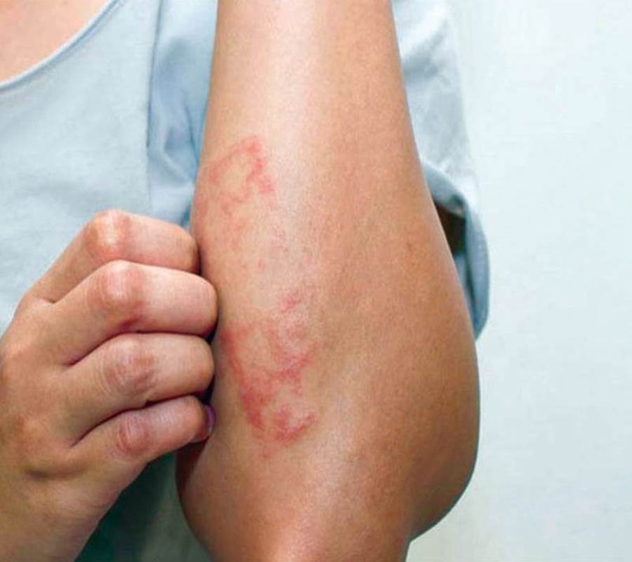 أعراض شائعة للسرطان لا يجب تجاهلها