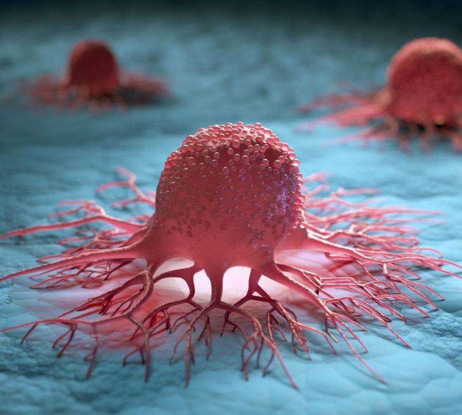 إعاقة بروتين MCL-1 تقضي على الخلايا السرطانية