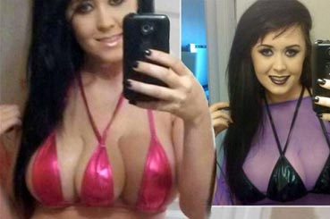 فتاة تجرى عملية لاضافة ثدى ثالث لصدرها لرغبتها فى النجومية
