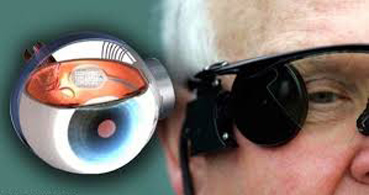  شركة فرنسية تبتكر مستشعرات تزرع في العين لاستعادة وظيفة البصر