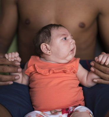 فيروس زيكا ينتقل للطفل عن طريق الرضاعة