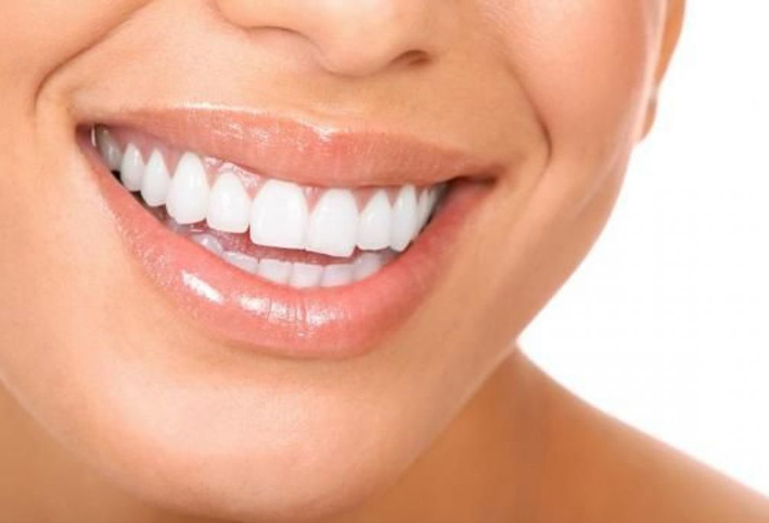 عادات ضارة تدمر مينا الأسنان