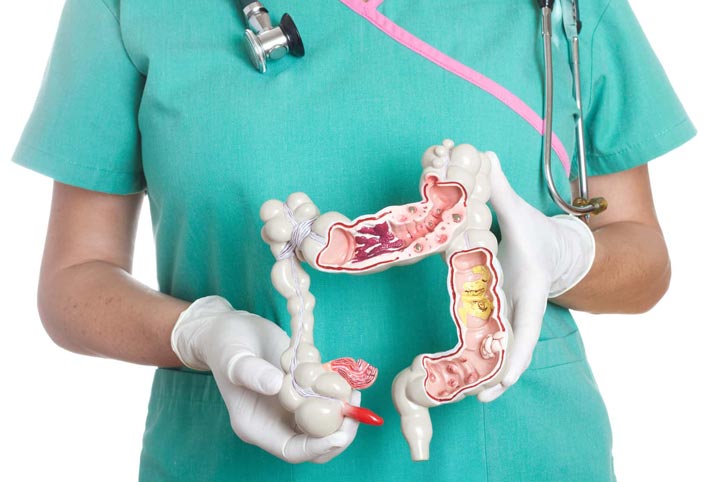 تعرفي على خطوات للوقاية من سرطان القولون