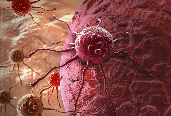 دراسة تكشف تقنية جديدة لتدمير السرطان بنفسه
