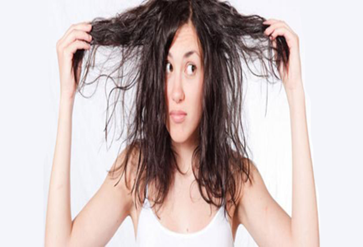 نقص فيتامين (د) والمشاكل الأخرى المؤثرة على  الشعر