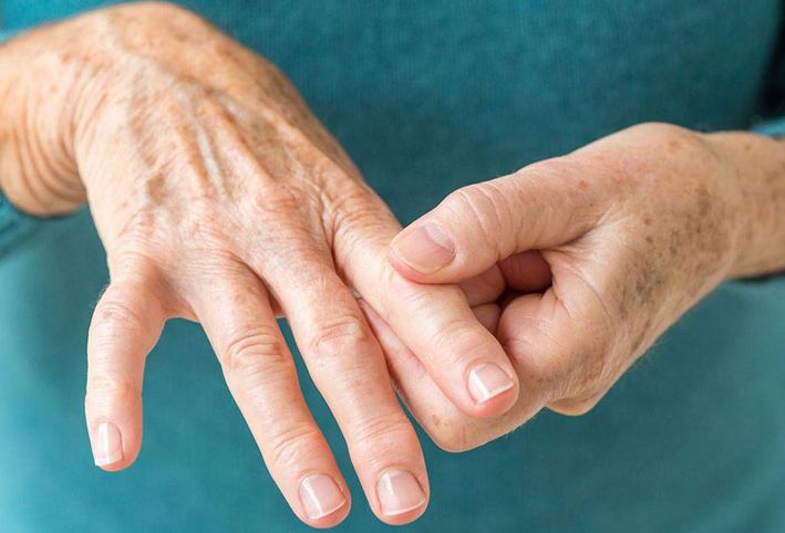استخدام المضادات الحيوية قد يزيد خطر التهاب المفاصل الروماتويدي