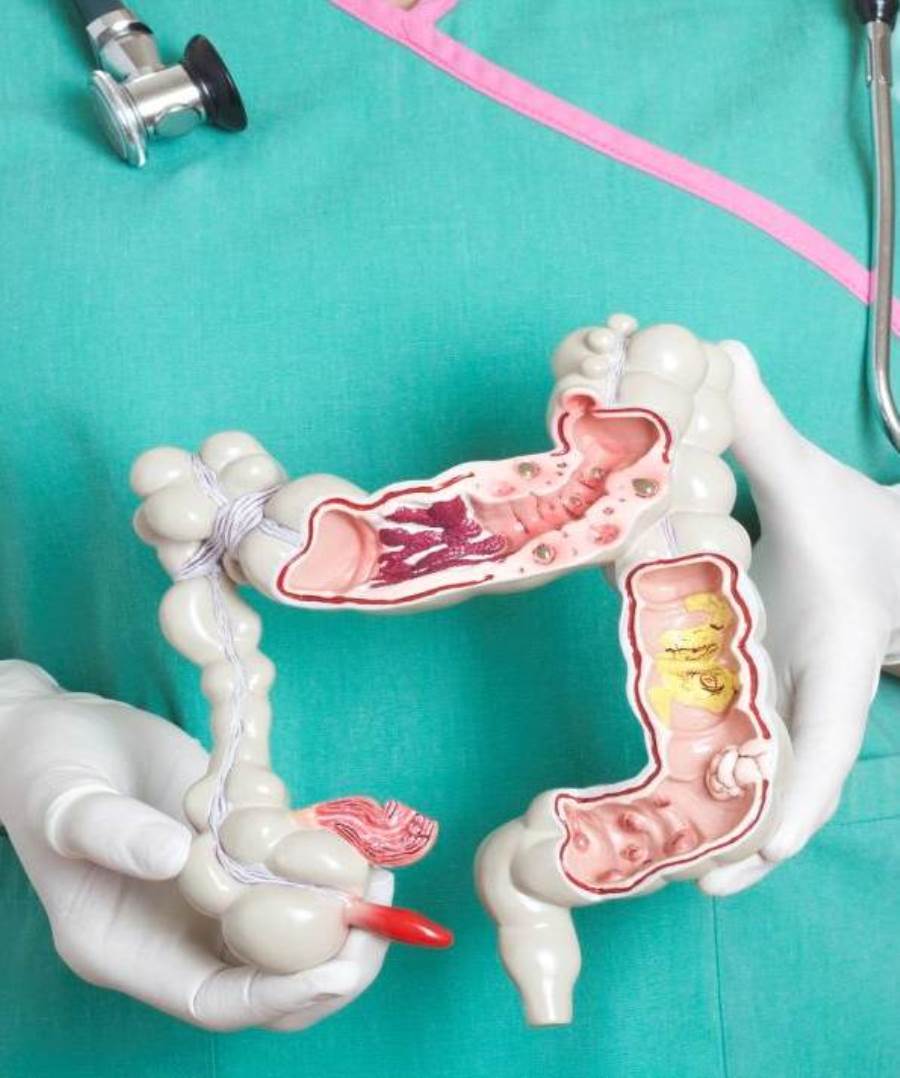 لدي حويصلات جيوب القولون، وتلتهب لدي من آن لآخر، وأتناول حينذاك العلاج، ما الأطعمة المفيدة والأطعمة المهيجة للحالة لدي؟
