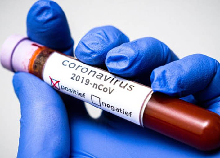 ثلاثة أنواع من فيروس كورونا تنتشر حول العالم