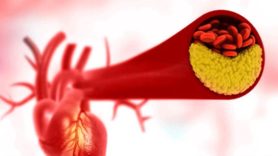 طرق لحماية الشرايين