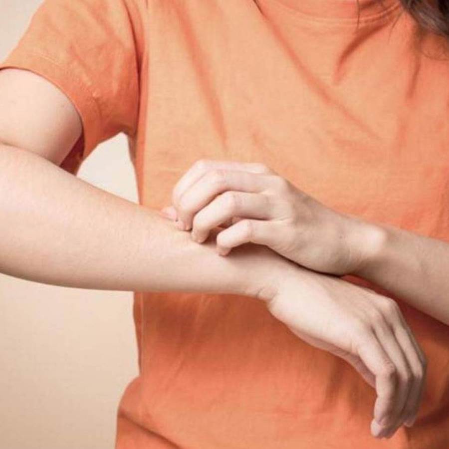 للتخلص من تشققات الجلد .. اليك هذه الوصفة؟