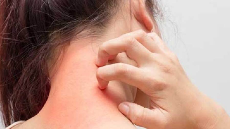 حساسية الجسم