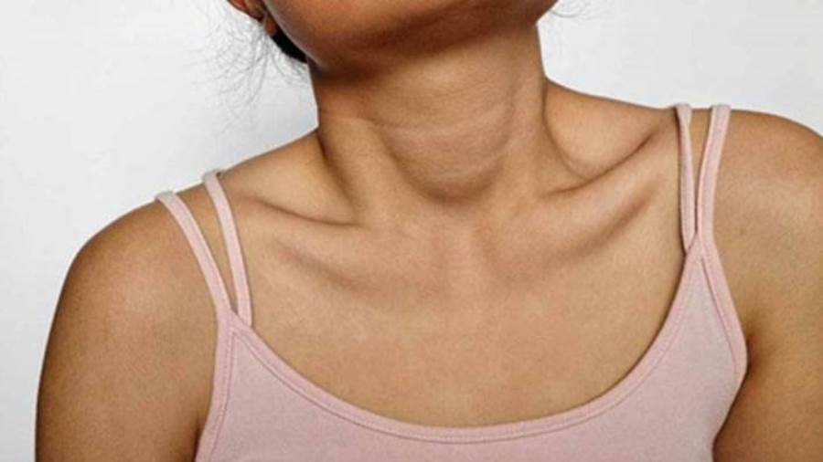 علاجات تفتيح الركبة الداكنة