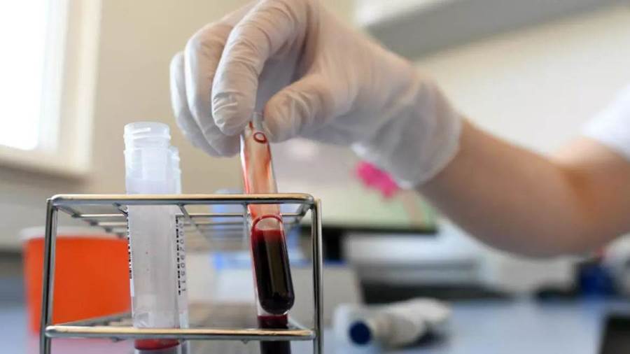 العلاج ببلازما المتعافين نجح بنسبة 35%