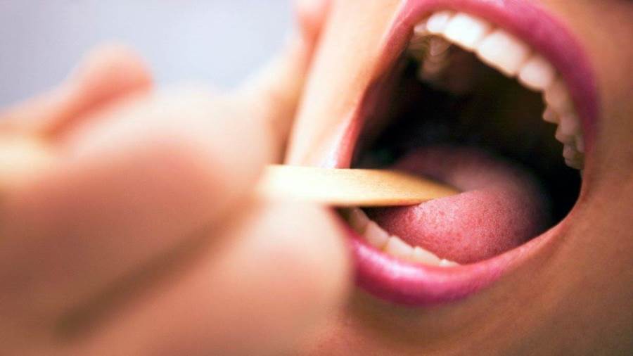 اختبار الحمض النووي يمكن أن يتنبأ بسرطان الحلق حتى 8 سنوات