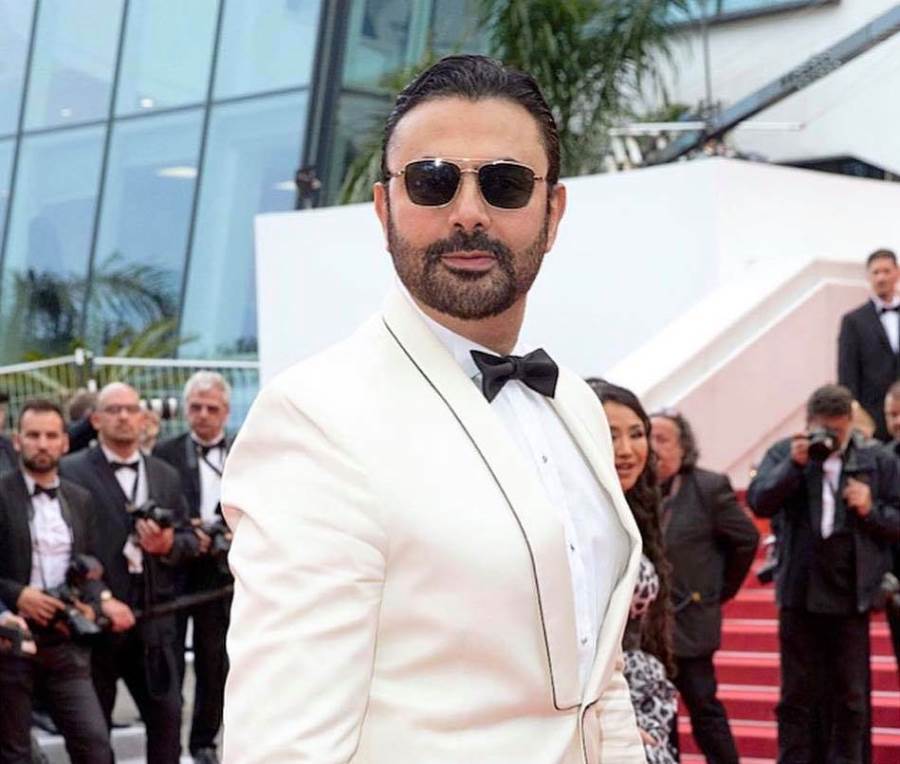 النجم محمد كريم يتعرض لحادث سير في كاليفورنيا