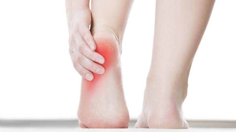 علاجات طبيعية تخلصك من اللام الكعب