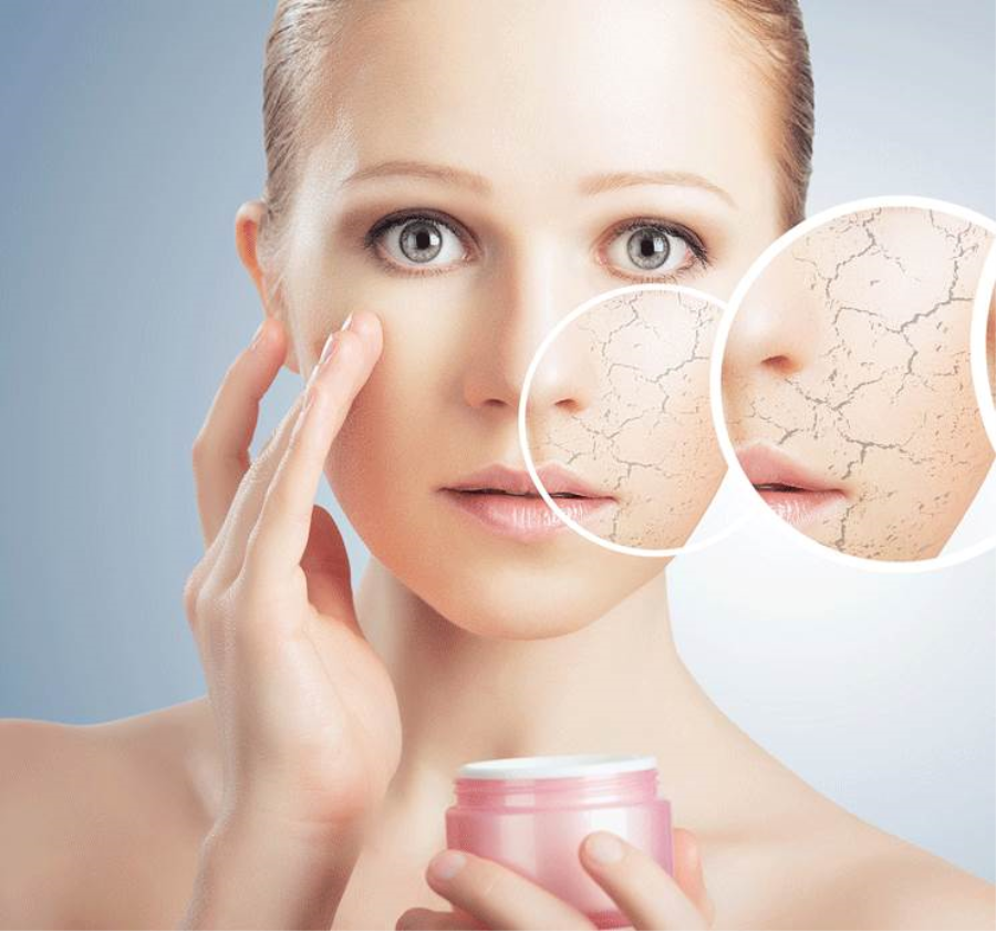 طرق علاج جفاف البشرة في الشتاء