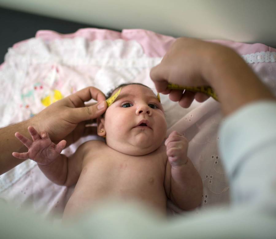دراسة حديثة: فيروس زيكا يؤثر على نمو العين قبل الولادة وليس بعدها