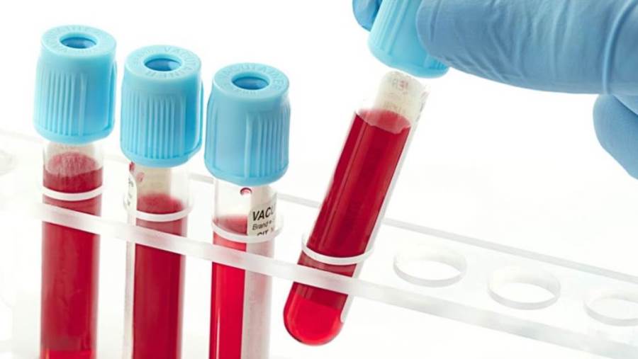 اختبار للدم يتنبأ بقدرة مريض السرطان على الاستفادة من العلاج الكيميائى