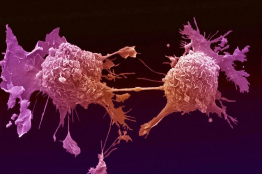 هل جهاز المناعة يقضي على سرطان البروستاتا؟