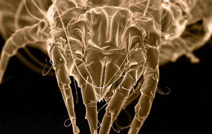 شبيهة بالعناكب .. حشرات تعشش في مسام جلدنا 