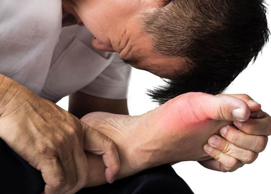  4 علاجات منزلية للتخلص من النقرس