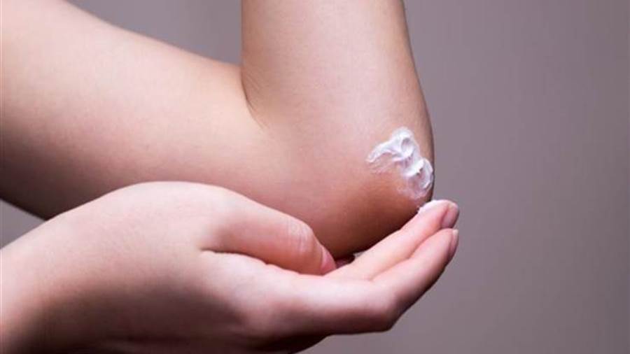 إسمرار الكوع والركبتين