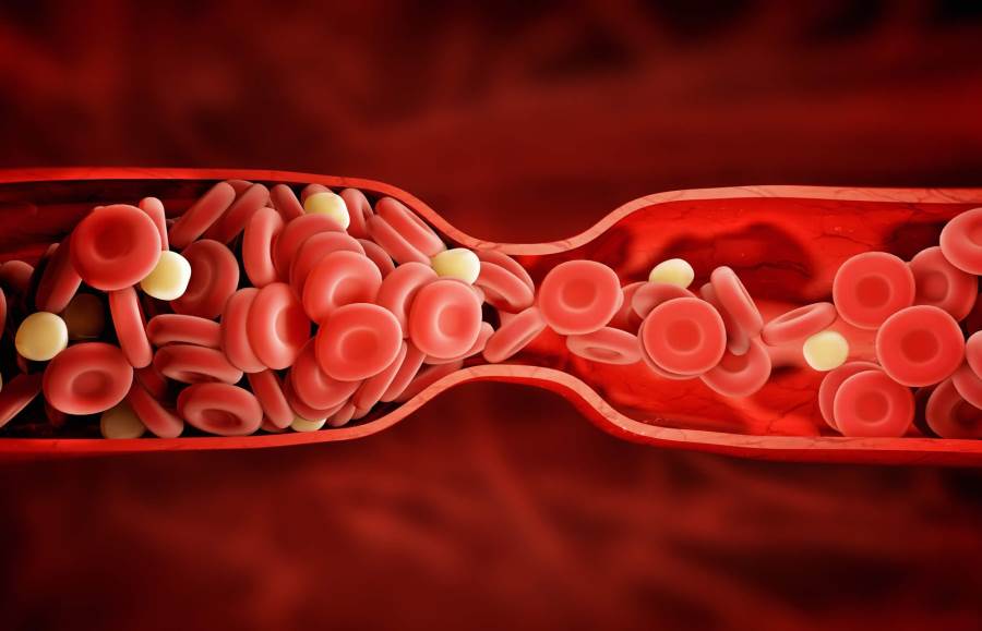 متى يطلب طبيبك تحليل INR لكشف مدة تجلط الدم؟