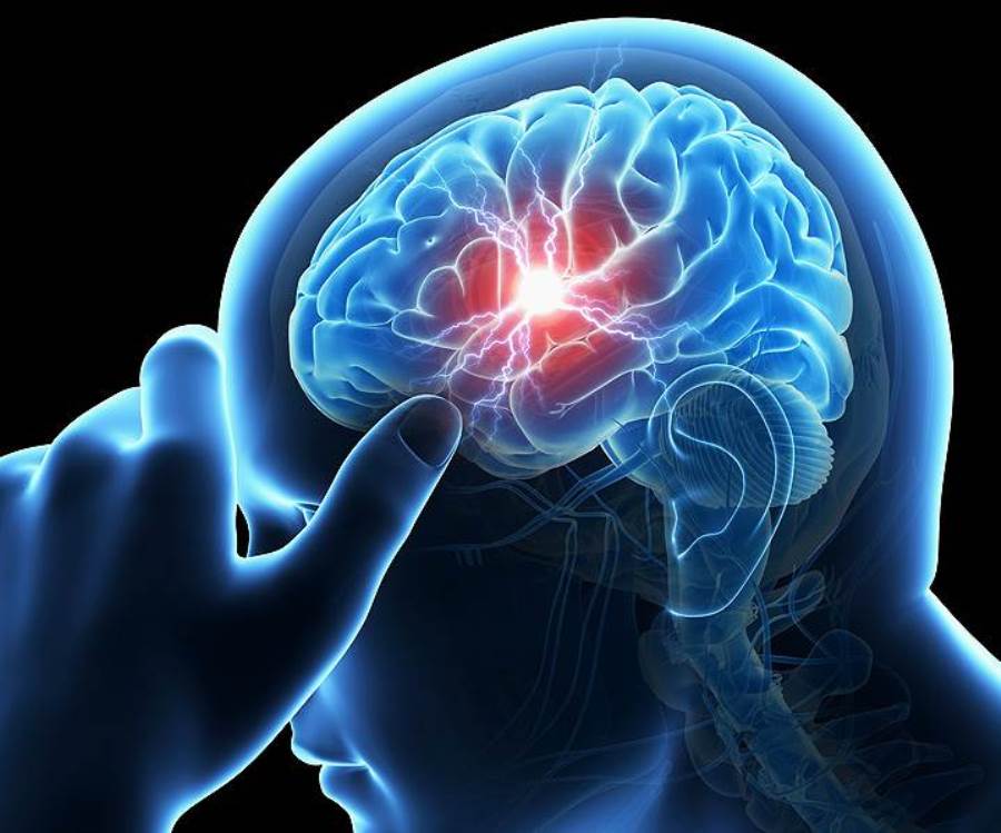 أحدث طرق علاج الجلطة الدماغية