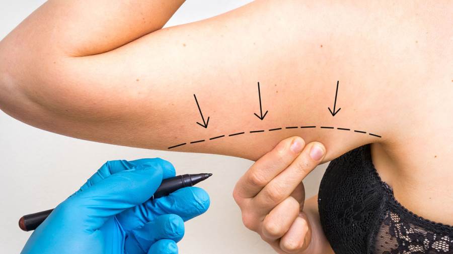 عملية شد الذراعين