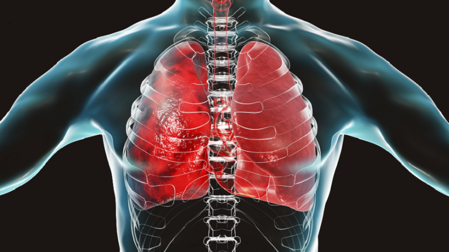 الرئة عند الإصابة بكورونا