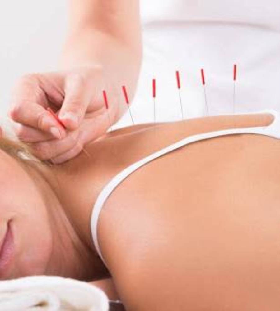هل علاج الوخز بالإبر مفيد في علاج مشاكل العظام؟