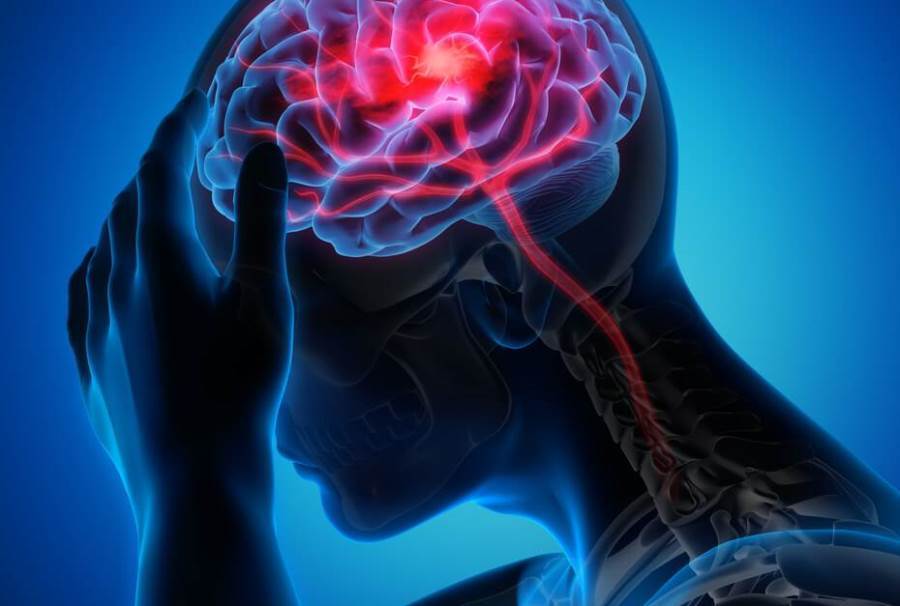 دراسة تكشف أخطر وقت خلال اليوم للإصابة بالسكتة الدماغية