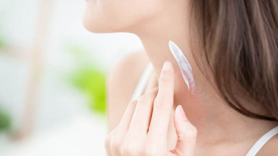 مرهم لعلاج آلام الرقبة